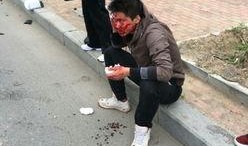 旅顺车祸最新爆料,事故原因揭秘，伤亡情况公布